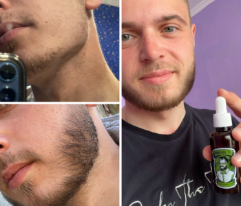 Лосьйон для росту бороди minoxidil:7%&nbsp; (200&nbsp;мл)ㅤ