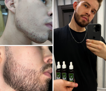 Лосьйон для росту бороди minoxidil:7%&nbsp; (200&nbsp;мл)ㅤ