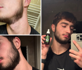 Лосьйон для росту бороди minoxidil:7%&nbsp; (200&nbsp;мл)ㅤ