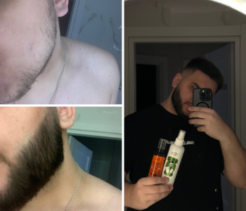Лосьйон для росту бороди minoxidil:7%&nbsp; (200&nbsp;мл)ㅤ
