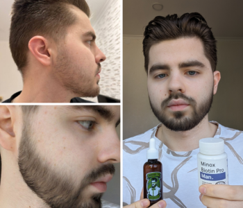 Лосьйон для росту бороди minoxidil:7%&nbsp; (200&nbsp;мл)ㅤ