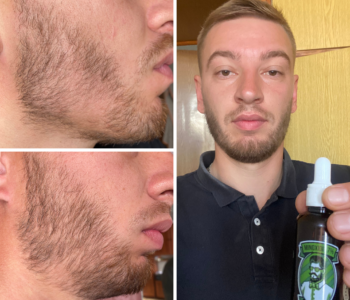 Лосьйон для росту бороди minoxidil:7%&nbsp; (200&nbsp;мл)ㅤ