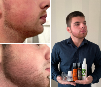 Лосьйон для росту бороди minoxidil:7%&nbsp; (200&nbsp;мл)ㅤ