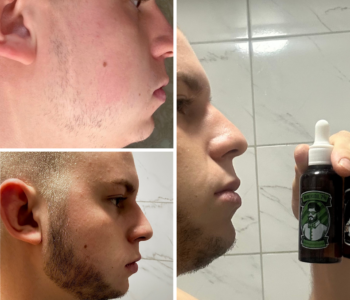 Лосьйон для росту бороди minoxidil:7%&nbsp; (200&nbsp;мл)ㅤ
