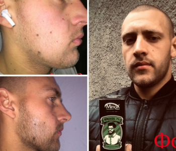 Лосьйон для росту бороди minoxidil:7%&nbsp; (200&nbsp;мл)ㅤ