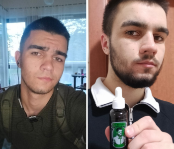 Лосьйон для росту бороди minoxidil:7%&nbsp; (200&nbsp;мл)ㅤ