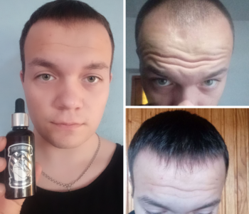 Лосьйон для росту волосся та бороди minoxidil:15% (50 мл)