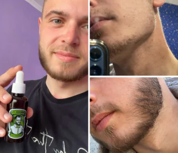 Лосьйон для росту бороди minoxidil:7%  (50 мл)ㅤ