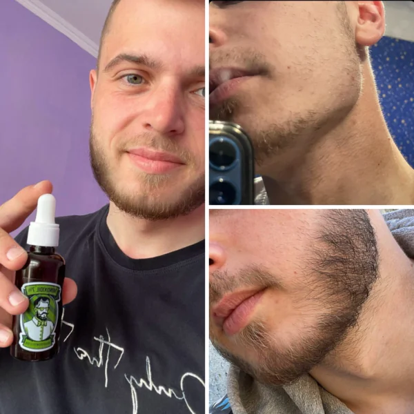 Лосьйон для росту бороди minoxidil:7%  (50 мл)ㅤ