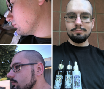 Лосьйон для росту волосся та бороди minoxidil10%(200 мл)